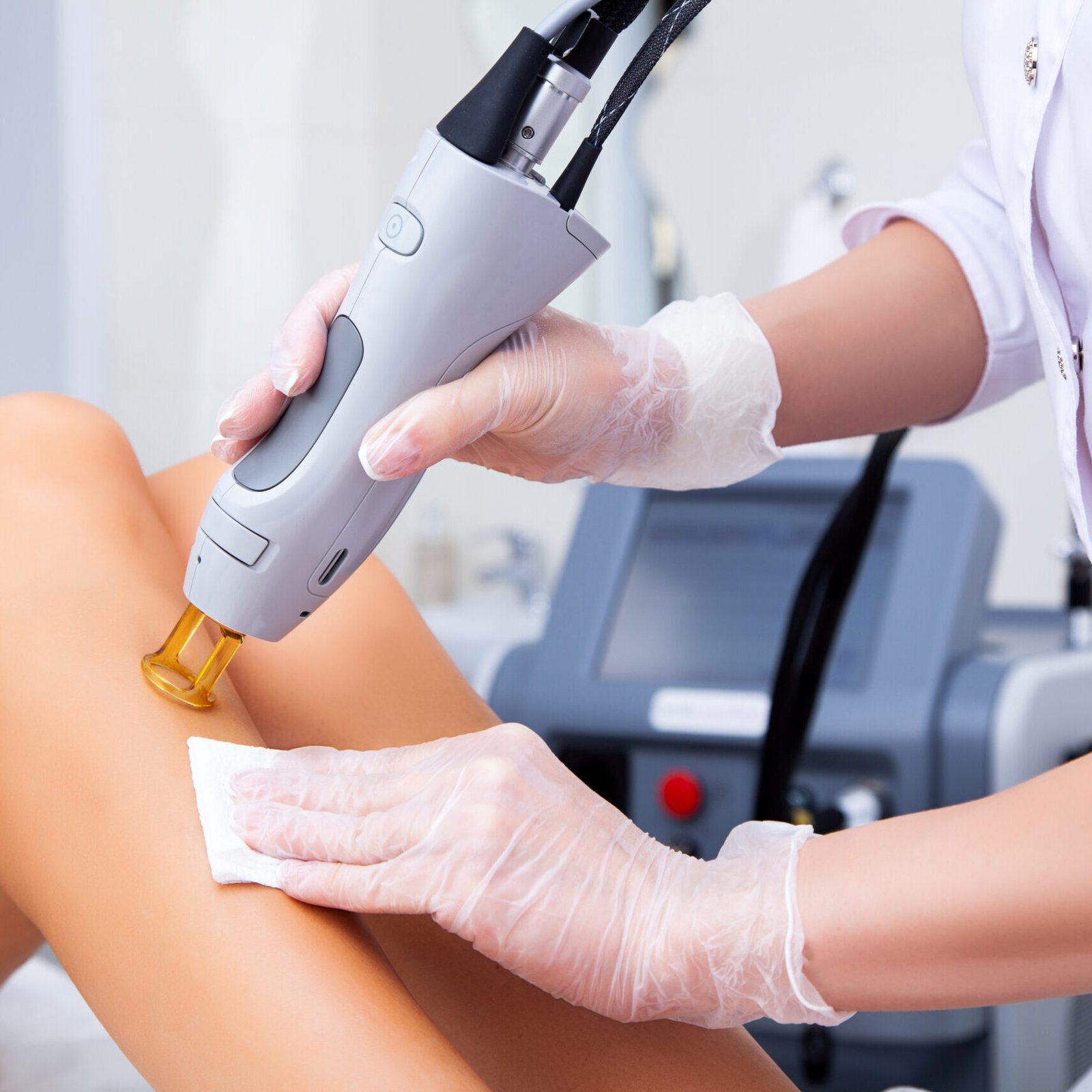 Epilation au laser Epilation au laser