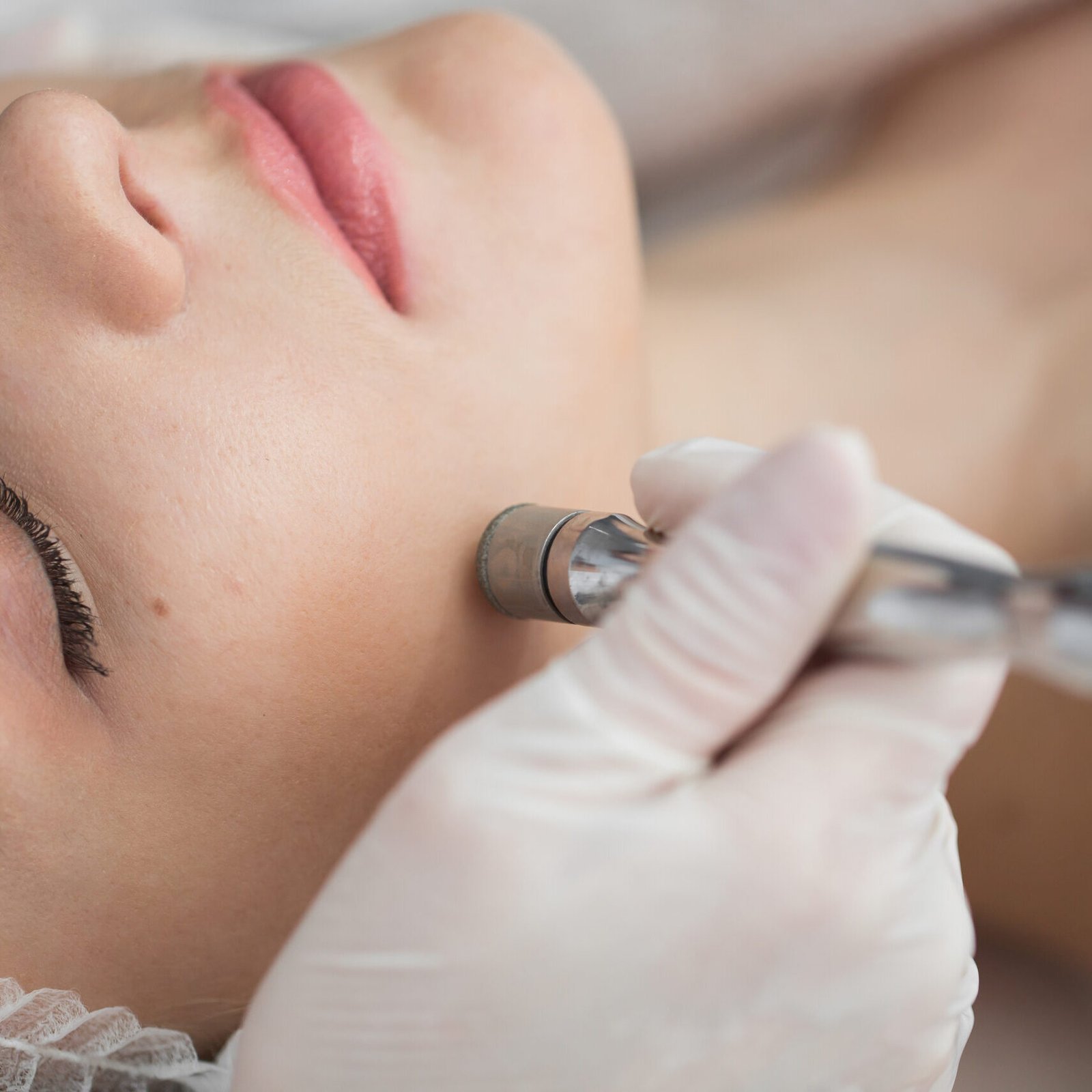 Diamond microdermabrasion, peeling cosmetic. woman during a microdermabrasion treatment in beauty salon Diamond microdermabrasion, peeling cosmetic. woman during a microdermabrasion treatment in beauty salon