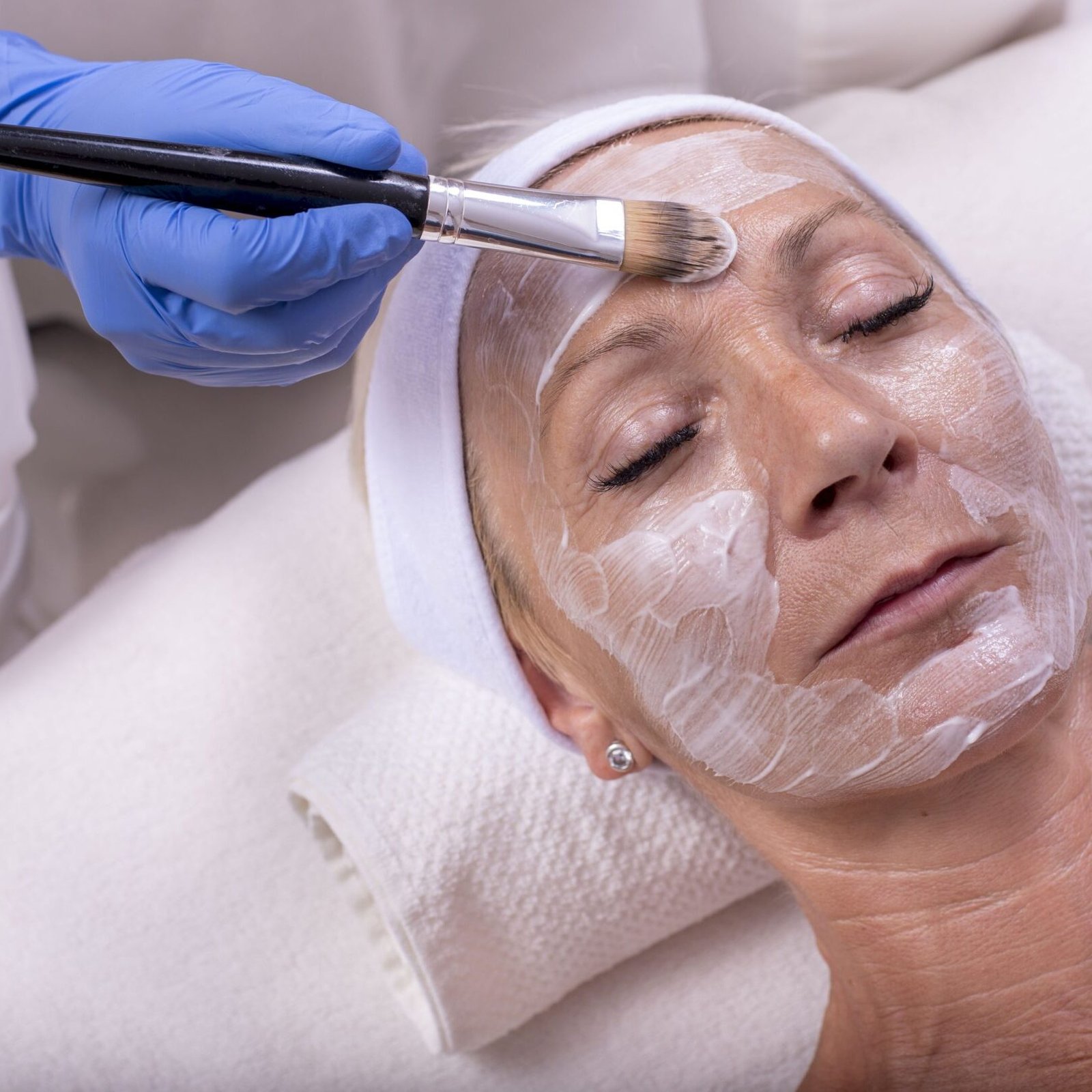 A person with blue rubber gloves spreading a white crème over the face of a woman